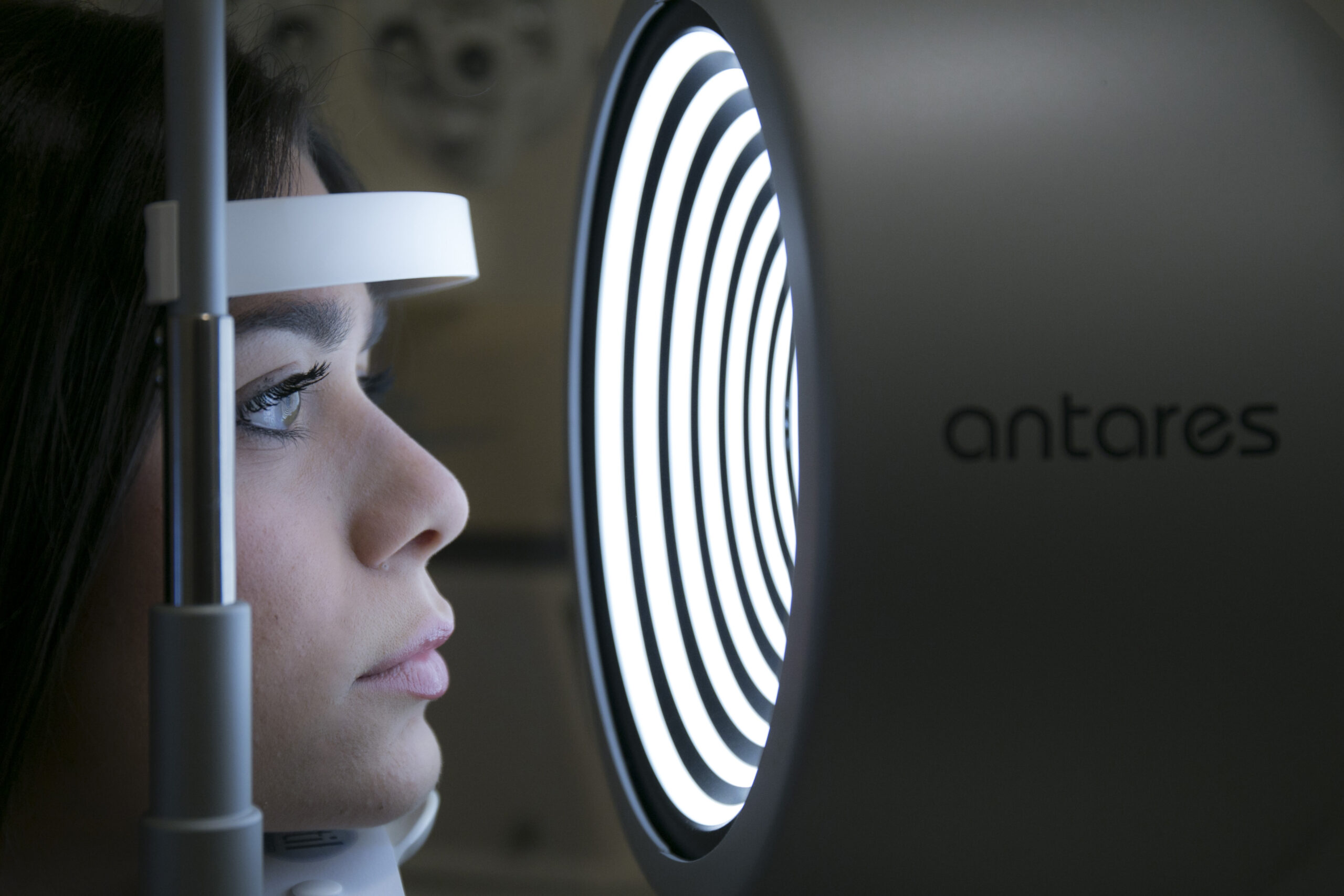 Lenti a contatto notturne Vicenza | Ortocheratologia Stecca Optometria